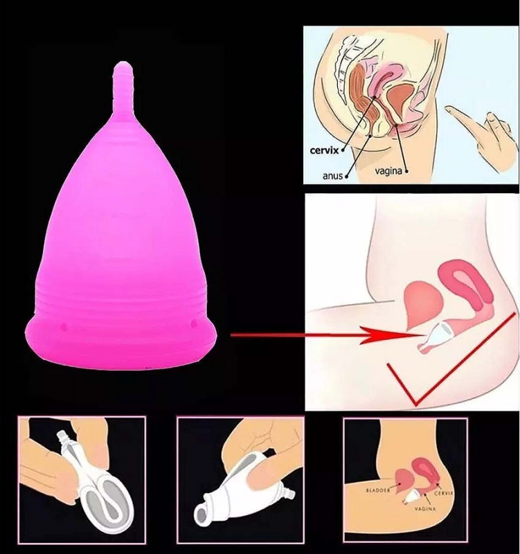 Менструальная чаша